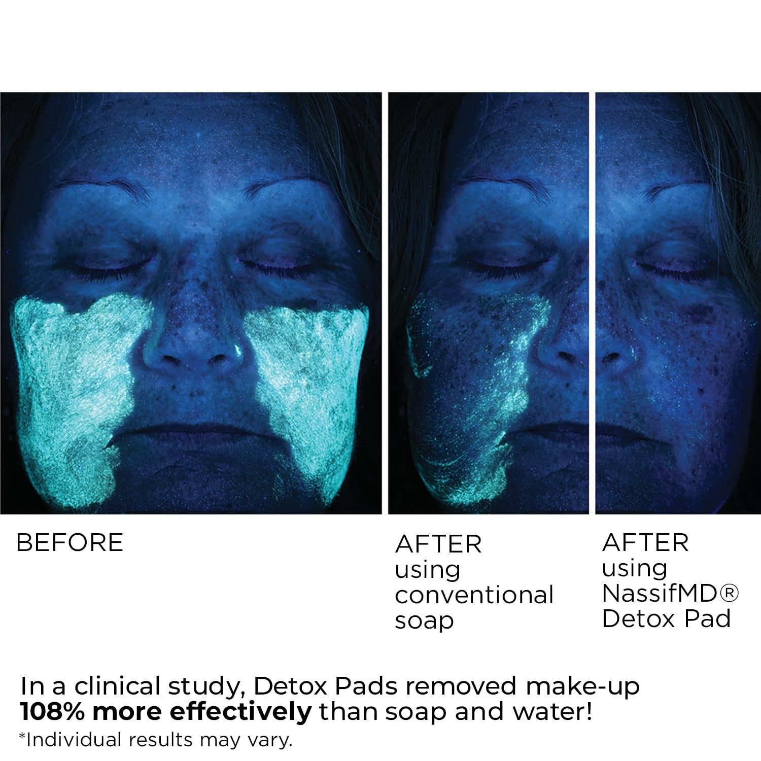 Nassifmd Detox Pads Facial Radiance Pads, Glycolic Acid Pads, Witch Hazel Toner, Face Exfoliating Pads Salicylic Acid Wipes, BHA AHA Pads, Resurfacing Pads for Face (30 Count or 60 Count)