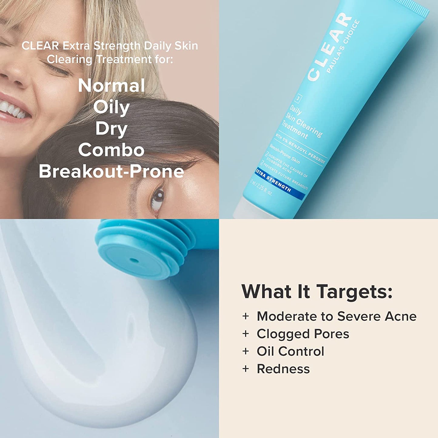 CLEAR Daily Skin Clearing Treatment with Benzoyl Peroxide, Treats and Prevents Mild to Severe Acne & Breakouts, Fragrance-Free, 2.25 Fl. Oz.